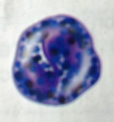 Nucleus lobed
Large blue-purple cytoplasmic granules