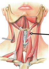 Thyroid cartilage (Oblique line of lamina)
