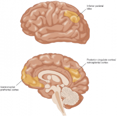 1) inferior parietal lobe 
2) posterior cingulate cortex/retrospienal cortex
3) ventromedial prefrontal cortex