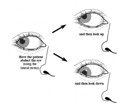 Problem


Rectus and Oblique muscles overlap in function:


- Sup. rectus, inf. oblique = elevate eyeball


- Inf. rectus, sup. oblique = depress eyeball


 


"Rectus Returns" - Rectus muscles ADduct eye


"Oblique is Off to the Side...