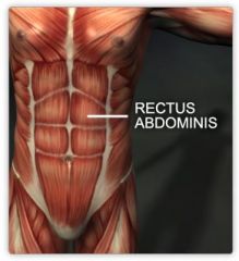 Rectus abdominus