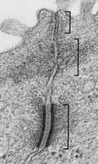 The picture shows an Electron micrograph of a junctional complex
between epithelial cells of a salivary gland.
Label the 3 parts

