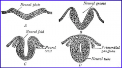 neural plate > neural groove > neural fold > neural tube
