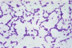 Is this a positive or negative gram stain?