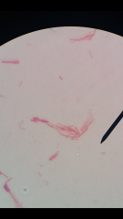 Identify this spore stain and determine if it is gram-positive or negative