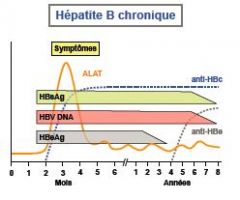 Hépatite B chronique