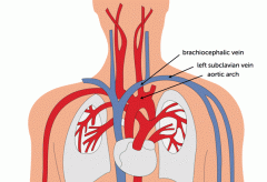 In the upper chest are formed by the union of each corresponding internal jugular vein and subclavian vein.