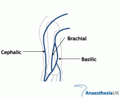 Is a superficial vein of the upper limb and communicates with the basilic vein.