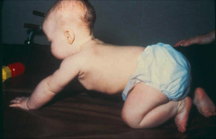 Position: place child in ventral
position supported by trunk, over examiner’s knee or place in quadruped
position
Stimulus: examiner passively flexes
then extends the child’s head and neck 
Response

(1)  Head and neck flexion produces
...