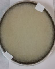 Identify this by name


Yeast or Mold