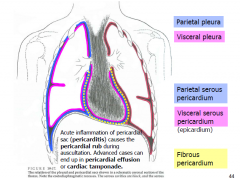 Acute inflammation of pericardial sac (pericarditis) causes the pericardial rub during auscultation. Advanced cases end up in pericardial effusion of cardiac tamponade.