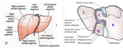 L&R lobes, Quadrate Lobe, Caudate lobe.
Falciform ligament separates L from R, gallbladder and porta hepatis separate quadrate and caudate. The quadrate and caudate are on L side.