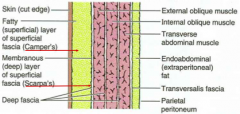 -Skin 


-Fatty (superficial) layer of superficial fascia (Camper's)


-Membranous (deep) layer of superficial fascia (Scarpa's)


-Deep fascia


-External oblique muscle


-Internal oblique


-Transverse abdominal 


-Endoabdomina...
