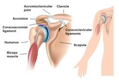 - lateral clavicle to acromion process (seperated by articular disc)
 
- responsible for allowing total arm movement through accessory movements
 
- transmits force between the clavicle and acromion