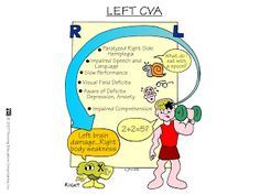 CVA-- L vs R