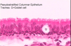 Describe pseudostratified columnar epithelium. Function? Location?