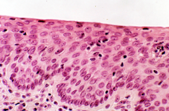 Describe stratified squamous epithelium. Function? Location?