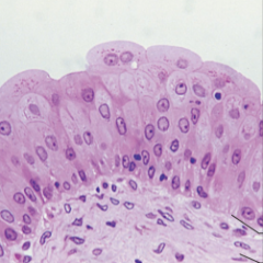 Describe transitional epithelium. Function? Location?