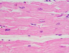 Describe cardiac muscle tissue. Function? Location?