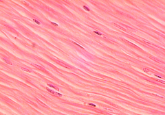 Describe smooth muscle tissue. Function? Location?