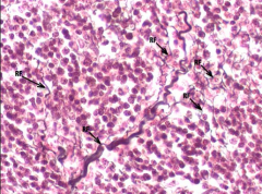 Describe reticular connective tissue. What is its function? Location?