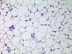 Describe adipose connective tissue. What is its function? Location?