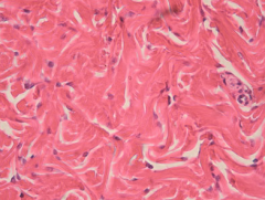 Describe dense irregular connective tissue. What is its function? Location?