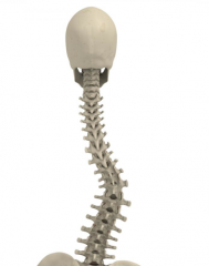 What is this called? Which vertebral columns are involved?