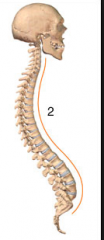 What is this called? Which vertebral columns are involved?