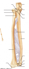 Name structures, bones of forearm, anterior view