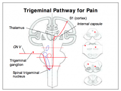 Primary afferent fibers carrying pain and
temperature sensations enter the brainstem at the pons. 

- Instead of synapsing in the principal (chief) sensory nucleus of CN V, the fibers descend ipsilaterally in the Spinal trigeminal tract, to synapse in 