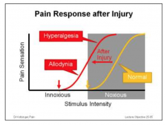 The response curve showing the level of pain sensation in relation to stimulus intensity is shifted to the left. Based on this, previously painless stimuli become painful (allodynia) and the intensity of sensations already painful under normal circumstanc