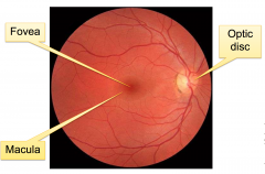 - The back of the eye ball, the ocular fundus, can be examined using an ophthalmoscope. 
- The optic nerve head (optic disk) can be easily identified by the radially emerging blood vessels originating in the center of the optic nerve. 
- The fovea forms