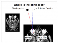 Since the optic disk region does not contain photoreceptor, the visual information of this region is lost
