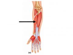 Action: Flexion (thumb), Flexion (wrist), Abduction (wrist)
Origin: Anterior shaft of radius & interosseous membrane
Insertion: Base of distal phalanx of thumb