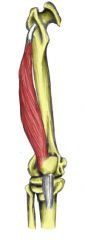 Action: Extension (knee)
Origin: Inferior to greater trochanter 
Insertion: Tibial tuberosity