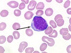 The cell above is in the myelogenous line. What is this cell according to maturation?