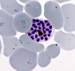 what plasmodium species is noted if 15 paracites are observed in a single schizont with schauffners dots?