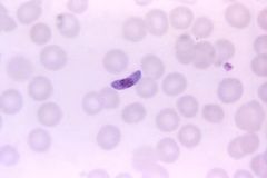 what plasmodium species is noted if only banana shaped gametocytes are observed