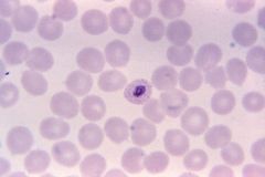 what plasmodium species is noted if the slanted ring shape is observed in the RBC?