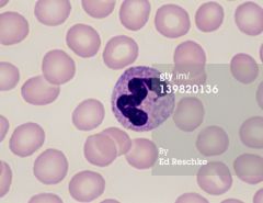 What is the unusual projection on the top end of the neutrophils nucleus?