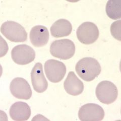 What are the dark RBC inclusions in this photo?