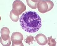 the banded neutrophil is exhibiting what anomaly?
