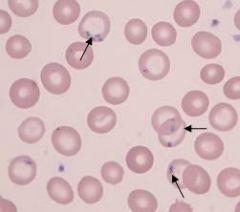 what are the RBC inclusions shown and what are they made from?