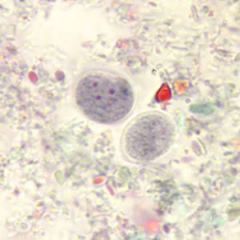 Human gut amoeba
Found in verts & inverts
Endocommensal in human colon with high prevalence
In mature cyst, four nuclei and no chromatid bodies
In troph, large irregular endosome in nucleus
Varies in shape - can be an oval