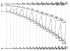 Recorded signal cut into elementary components (at fundamental period markers), which are overlaid and added to make a new signal with different fundamental frequency. Fundamental frequency and thus prosody can be adjusted by elementary component ...