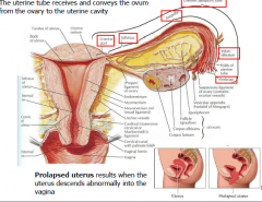 Uterine tube recieves and conveys the ovum from the ovary to the uterine cavity
Prolapsed uterus results when uterus descends abnormally into vagina.