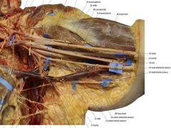 The posterior antebrachial cutaneous nerve (PABCN) branches from the radial nerve in the axilla.

The posterior antebrachial cutaneous nerve branches from the radial nerve just distal to the posterior brachial cutaneous nerve (PBCN) in the axill...