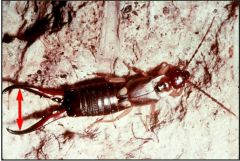 Order Dermaptera


Common name: earwig


 


Key traits: short wing covers, Abdominal cerci modified as pincers