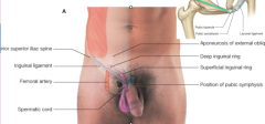 location
> ASIS, pubic tubercle
> near inguinal canal
structure:
> external oblique aponeuroses 
